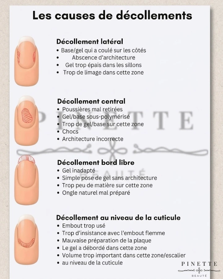 causes des décollements des ongles en gel